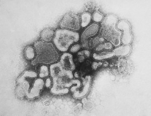 Influenzaviren der Spanischen Grippe