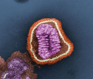 Influenzavirus (kolorierte TEM-Aufnahme)