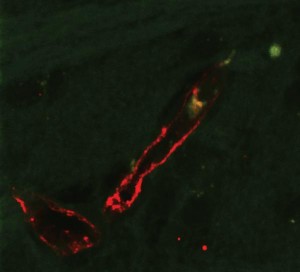 Monozyten in (gelb) und außerhalb (grün, rechts oben) eines Hirnblutgefäßes (rot)