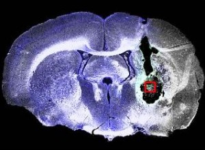 Die schwarzen Flächen rechts sind die durch den Schlaganfall erzeugten Löcher im Gehirn der Ratte. Das rote Quadrat markiert den Bereich, in dem wieder neues Gewebe gewachsen ist.