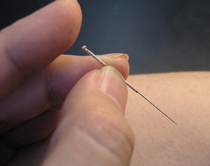 Akupunkturnadel wie sie heute üblicherweise Einsatz findet