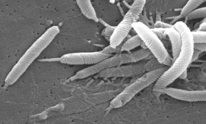 Helicobacter pylori im Rasterelektronenmikroskop