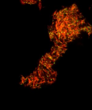 Protein-Fäden im Sperma (rot) helfen HI-Viren (grüne Punkte) weiße Blutzellen anzugreifen