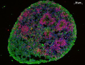 Menschliches Gehirn-Organoid mit unterschiedlichen Zelltypen: unreife, teilungsfähige Zellen (rot), reife Neuronen (grün)