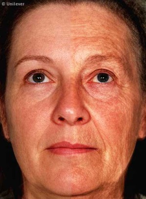 Ein aus jeweils zwölf Einzelaufnahmen kombiniertes Gesicht einer 47-jährigen (linke Gesichtshälfte) und einer 70-jährigen Frau (rechte Gesichtshälfte) verdeutlicht altersbedingte Veränderungen der Haut.