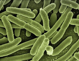 Nach dem Erwerb einer Doxycyclin-Resistenz wachsen Escherichia coli-Bakterien schneller und dichter als zuvor.