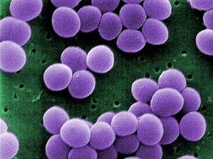 In Krankenhäusern können sich multiresistente Formen von Staphylococcus aureus entwickeln (kolorierte rasterelektronenmikroskopische Aufnahme).