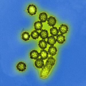 Trockene Luft schwächt Immunabwehr von Grippeviren thumbnail