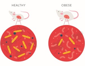 Immundefekt verändert Darmflora und verursacht Fettleibigkeit thumbnail