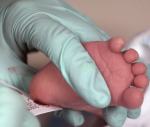 Blutentnahme aus der Ferse bei einem Säugling