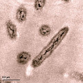 Diese Bakterien der Art Shewanella loihica produzieren bei der Verdauung von Laktaten Strom 