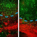 Nach einer Behandlung mit Imipraminblau (rechts) dringen weniger Glioblastomzellen (grün) in gesundes Gewebe (rot) ein als ohne diese Behandlung (links).