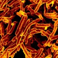 Mycobacterium tuberculosis-Bakterien, die Erreger der Tuberkulose, in einer gefärbten rasterelektronenmikroskopischen Aufnahme
