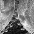 Elektronenmikroskopische Aufnahme der Zahnräder an den Hinterbeinen der Echten Käferzikade