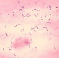 Eine bestimmte Variante des Karieserregers Streptococcus mutans kann Hirnblutungen auslösen und so einen Schlaganfall verursachen.