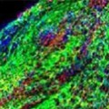 Das Protein 3K3A-APC verstärkt die Entwicklung funktionsfähiger Neuronen aus implantierten neuralen Stammzellen (rot gefärbt).