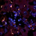 Enterococcus gallinarum-Bakterien (orange Flecke) sind in die Leber einer erkrankten Maus eingewandert (fluoreszenzmikroskopische Aufnahme).