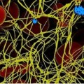 Bei der Blutgerinnung wickeln sich scheinbar endlose Fibrinfasern (gelb) um rote Blutkörperchen (rot) und Blutplättchen (blau).
