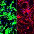 Mäuse-Astrozyten (links, grün gefärbt) lassen sich durch eine Behandlung mit Antisense-Oligonukleotiden zu Neuronen (rechts, rot gefärbt) reprogrammieren.