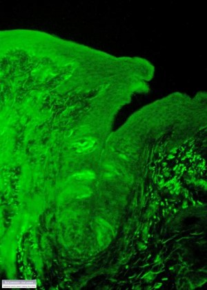 Leuchtend hellgrün angefärbte Kalziumrezeptoren in einer Geschmacksknospe der Zunge einer Ratte