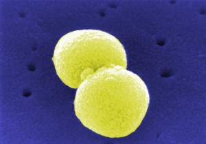 Pneumokokken (Streptococcus pneumoniae) im Rasterelektronenmikroskop