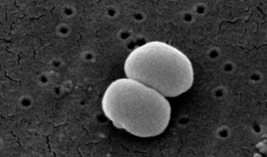 Ein typischer Hautkeim: Staphylococcus epidermidis (im Rasterelektronenmikroskop)