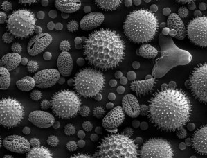 Pollen verschiedener Pflanzen im Elektronenmikroskop