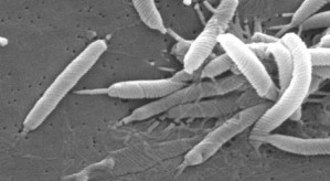 Helicobacter pylori im Rasterelektronenmikroskop