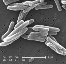 Mycobacterium tuberculosis im Rasterelektronenmikroskop