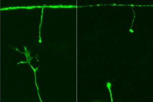 Links (dlk-1-Gen aktiv): Die untere Nervenzelle bildet neue Fortsätze nach oben; Rechts (dlk-1-Gen inaktiv): Kein Wachstum