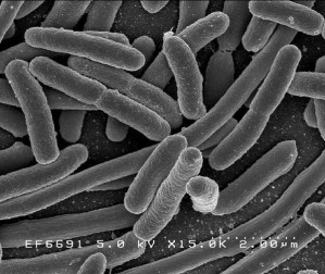 Escherichia coli im Rasterelektronenmikroskop