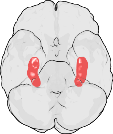 Lage der Hippocampi im menschlichen Gehirn. Ansicht von unten (die Stirn liegt im Bild oben)