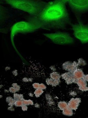 Fibroblasten von Fanconi-Anämie-Patienten nach genetischer Korrektur (grün)