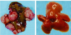 Mäuseleber mit Tumoren (links) und nach Behandlung mit Mikro-RNA (rechts)