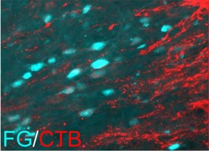 Neue Axone (rot) erreichen ihre Zielzellen (blau) im Gehirn