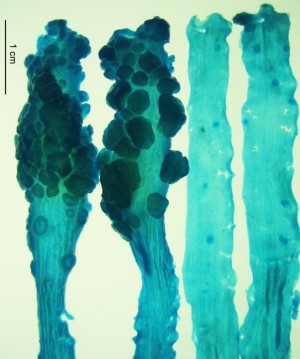 links: Tumoren im Darm von Mäusen drei Monate nach Infektion mit Toxin bildenden B. fragilis-Bakterien, rechts: Darm von nicht infizierten Mäusen (Methylenblau-Färbung)