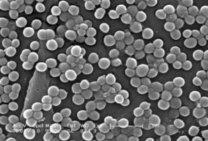 Staphylococcus aureus (MRSA-Stamm), rasterelektronenmikroskopische Aufnahme
