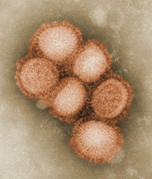 Schweingrippeviren (Influenza A H1N1), kolorierte elektronenmikroskopische Aufnahme