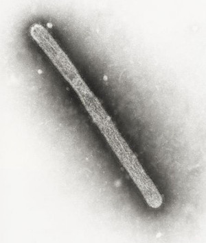 Eine transmissionselektronenmikroskopische Aufnahme eines Virus vom Typ H5N1