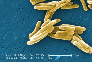 Mycobacterium tuberculosis (im Rasterelektronenmikroskop)