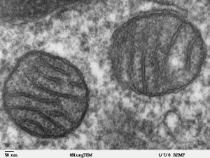 Foto: Elektronenmikroskopische Aufnahme zweier Mitochondrien