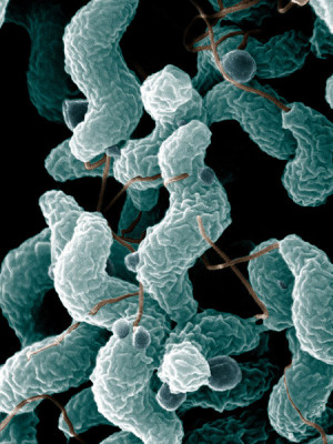 Campylobacter jejuni (elektronenmikroskopische Aufnahme)