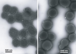 Elektronenmikroskopische Aufnahmen von M. mycoides JCVI-syn1.0 (links) und Wildtyp M. mycoides (rechts)