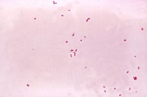 Das gefärbte mikroskopische Präparat zeigt die typischen Diplokokken von Neisseria meningitidis.