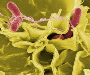 Gefärbte rasterelektronenmikroskopische Aufnahme von Salmonella typhimurium in einer Kultur menschlicher Zellen