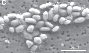 Rasterelektronenmikroskopische Aufnahme von Stamm GFAJ-1 nach Wachstum in einer Nährlösung mit Arsenat und ohne Phosphat
