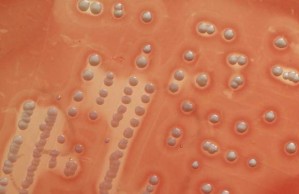 Staphylococcus aureus-Kolonien bilden auf Blutagar helle Höfe lysierter roter Blutkörperchen.