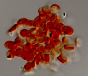 Äußerst flexible Hydrogelpartikel, die in Größe und Form roten Blutkörperchen ähneln 