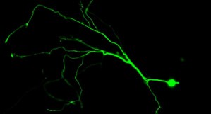 Fluoreszenzmarkiertes Neuron mit blockierter Apoptose