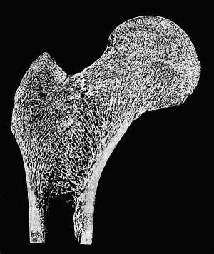 Feinstruktur des Oberschenkelknochens